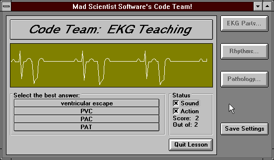 Screen shot of EKG Teaching