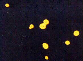 cryptococcus india ink
