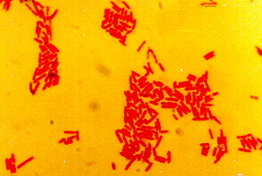 gram negative rods in wound culture