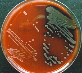torok tampon a mikroflóra dekódoló streptococcus on)