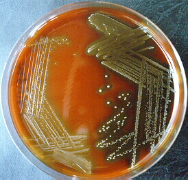 What are viridans streptococci?